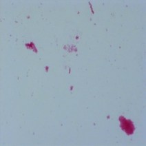 대장균(Escherichia Coil)
