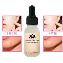 20ML Organic Tags Solutions 에센셜 오일 스킨 태그 리페어 솔루션으로 세럼 몰레 워터 Painless Face Wart Mole Freckle TSLM2|