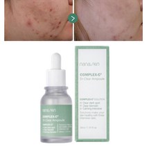 피부 여드름 붉은자국 붉은기 얼굴홍반 입주변 트러블 두드러기 눈가 색소침착 좁쌀