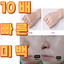 [약국용] 특허 기미잡티 검버섯크림 기미지우개 검버섯앰플 검버섯제거연고 반점제거 색소침착 멜라닌 기능성인증, 기미잡티 제거 미백 크림2개, 2개