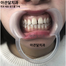 구강 교정기 치아 미백 100개 C형 입 오프너 확장기 개구기 치과 마우스 피스, M사이즈 10개, 10개