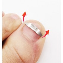 고고윙 발톱교정 발톱관리 용품 내성발톱 교정기 와이어 관리 도구, 1+1