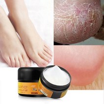 무좀 치료 기기 지료제 무좀 치료 기기 지료제 1box 천연 마유 발 크림 케어 각기 크림 운동 선수 발, 1개, 1개