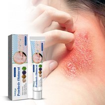 MAYEE 건선 연고 건선 두드러기 지루성피부염 접촉피부염 두피 건선 피부, 20ml, 2개