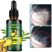 정수리 탈모 탈모증상 완화 기능성 헤어 바르는 헤어토닉 두피영양제, 1개, 30ml