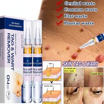 도난 방지택 제거 제거기 두더지 제거 액체 펜 치료 유두종 피부 태그 제거 사마귀 액체, 2개