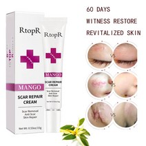 피부 흉터 제거 크림 얼굴 페이드 여드름 반점 치료 블랙헤드 화이트닝 스트레치 마크 뷰티, 1개