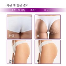 TTiiHot 성형 힙업 마사지 크림, 30g×5병