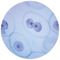 체세포분열(동물) 프레파라트, 상세페이지 참조