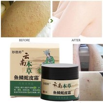 바이오 더마인텐시브밤 로라메르시에 일리윤세라마이드 엘리자베스아덴 꺄말덴 리페어 치킨 스킨 크림 다크 스팟 각화증 모공 제거 모이스처라이징 스무스 에센스 로션, 1개