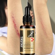 라벤더 리페어 에센스 흉터 제거 에센셜 마사지 오일 임산부용 히알루론산 세럼 페이스 개미, [04] 20ml, 04 20ml
