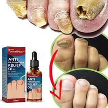 발톱무좀치료 발톱무좀연고 리페어 에센스, 10ml, 3개