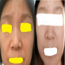 천연비누 고기능성 5장