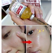 실리프팅 필러주름앰플 30ml/주름골 콜라겐 안티에이징 ﻿, 4)양악앰플 1개 아이보톡크림1개, 1개