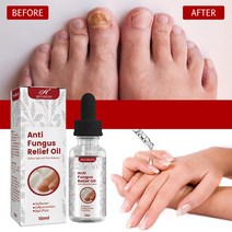 발톱무좀 네일 리페어 에센스 톱 발톱강화 손톱 영양제, 3개, 10ml