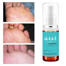 무좀 스프레이 약 발톱 각질 발바닥 발가락 간지럼 발 관리 풋케어, 55ml, 2개