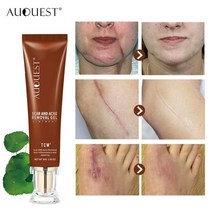 나이트 크림 달팽이크림 수분 영양 슬리핑 수면 탄력 바르는 콜라겐 auquest 흉터 수리 ​​스트레치 마크 여드름 제거 촉진 세포 재생 주근깨 반점 제거 스킨 케어, 여드름 흉터 제거제