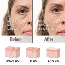 뱀독 펩타이드 아이 크림 보습 페이드 잔주름 제거 백 안티 에이징 방지 스킨 케어, 한개옵션0