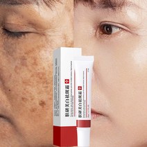 미백 크림 희석 반점 진정 트러블 개선 짙은 노란색 피부 주근깨 크림 페이드 스카 색소 기미 밝게 피부, 01. Whitening