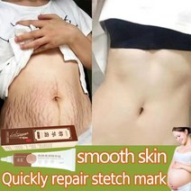 산후 비만 제거 스트레치 마크 크림 임산부 흉터 안티 에이징 안티 링클 퍼밍 바디 크림, 1개