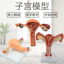 모형 난소 학습 피규어 교구 질 자궁 산부인과 인체, 병리 자궁 난소 자궁