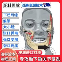 안면비대칭 마스크 얼굴 측두 하악 관절 장애 기 입 열기 하늘 크기 모양 턱 수축을 덮기 위해 부분 스냅, TMJ/D(암놈)