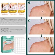 고주파실링기 120pcs 여드름 사마귀 제거 패치 스킨 태그 리무버 도구 트리트먼트 플랫 안티 감염 보이지 않는 스티커 케어