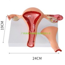 의료용 여성 생식 자궁 모형 난소 병리학 산부인과 진료 상담 교구, C