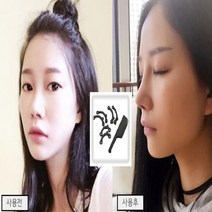 다파요 셀프 코성형 콧볼 축소 코뽕 코끝 높이기, 코뽕3쌍1SET