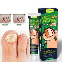 발톱무좀치료 발톱무좀약 발톱무좀 습진 가려움 발냄새 발각질 완화, 30g, 1개