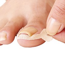 일본아이미디어 발가락보호 발톱보호 엄지발톱 밴드 케어테이프, 1세트