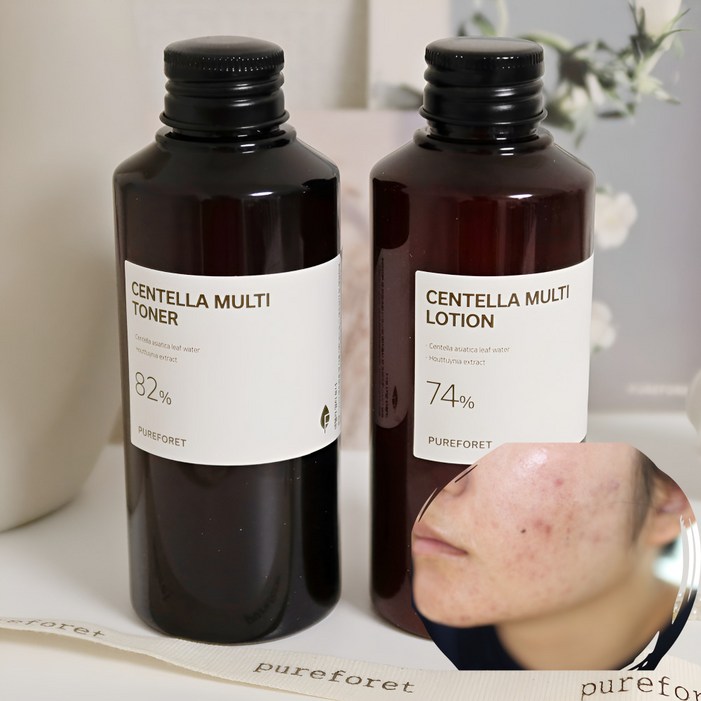 청소년 사춘기 여드름 화장품 스킨 로션 2종 기초세트 100식물성 병풀추출물