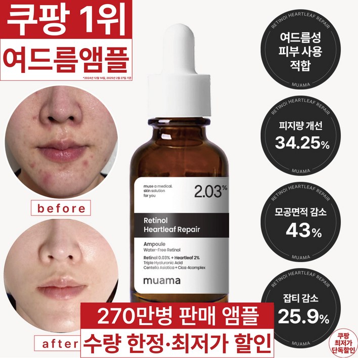 3일 여드름 순삭 진정, 피지감소, 모공면적감소 임상완료 270만병 판매기념 할인 고함량 레티놀 어성초 히알루론산 나이아신아마이드 뮤아마 앰플