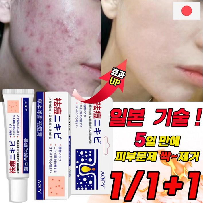 국내배송 여드름 연고 흉터 치료 제거 연고 색소침착 미백 크림