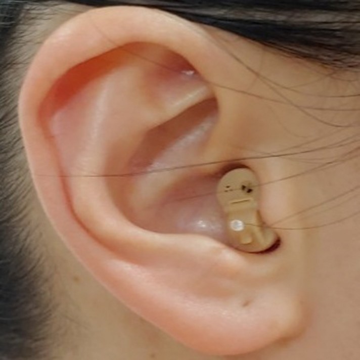 A3 HEARING AID 보청기센터에서 개발한 울림없는 음성증폭기, 1개, A3음성증폭기 왼쪽 (파랑색)