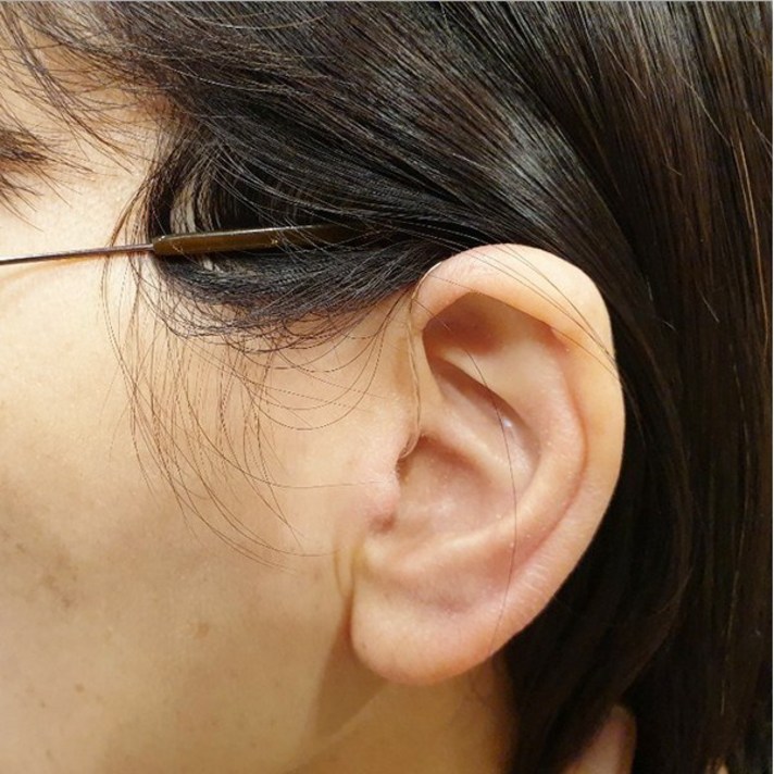 시그니아 독일보청기 무선 충전형 30일 무료체험 무료출장 홈케어서비스