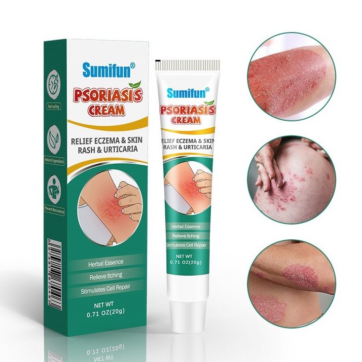 즉각케어피부 곰팡이균 연고 건선 가려움증 습진연고 피부 가려움증 20g S29, 1개, 20ml 즉각케어피부 곰팡이균 연고 건선 가려움증 습진연고 피부 가려움증 20g S29, 1개, 20ml