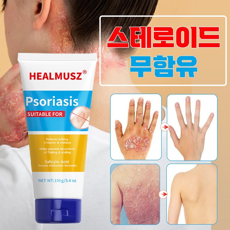 당일배송건선연고 완화 피부 가려움증 대상포진 지루성피부염 아토피 피부염 발진 피부 진정 크림 건선크림