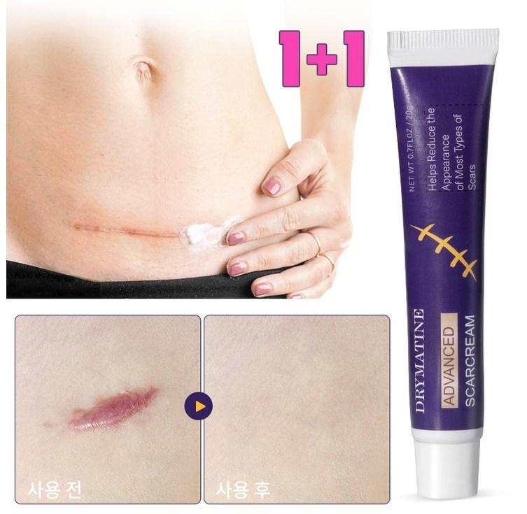 당일배송 DRYMATINE 흉터연고 흉터제거연고 재생크림 상처흉터연고 여드름흉터 수술흉터 화상물집 흉터제거연고 20g, 20ml, 2개