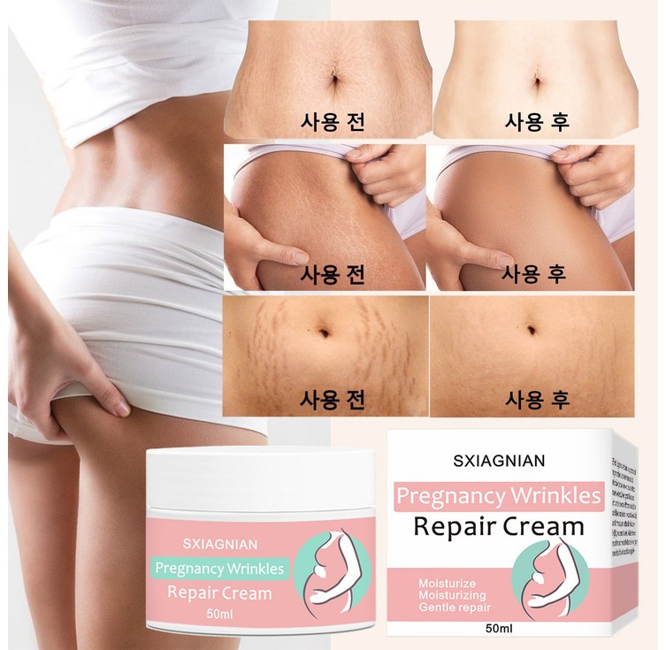 한국셀러본토출하임산부 산전후 튼살 탄력케어 크림 흉터관리 임산부 청소년 이용가능, 1개, 50g